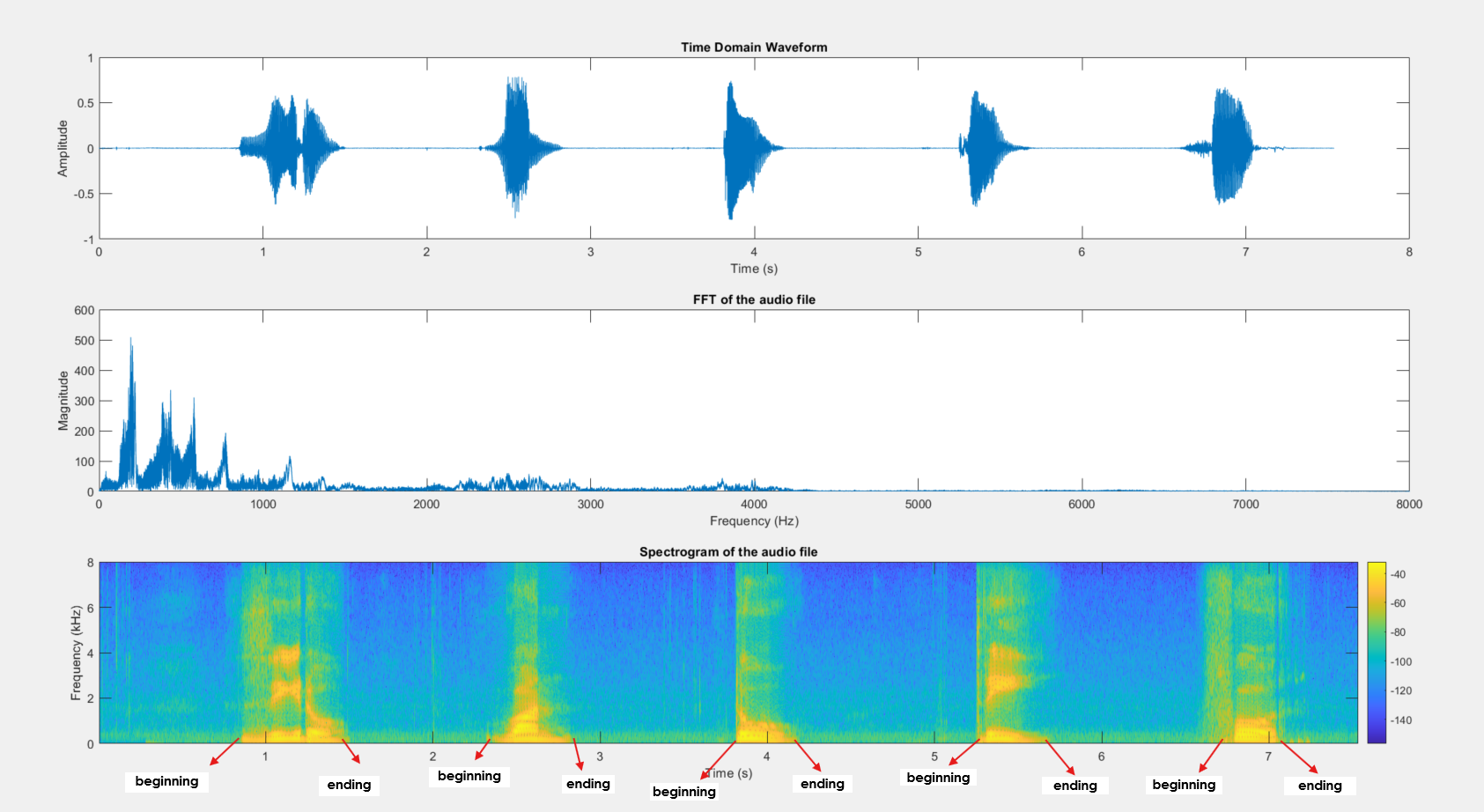 Digit Recognition using Speech Spectrograms